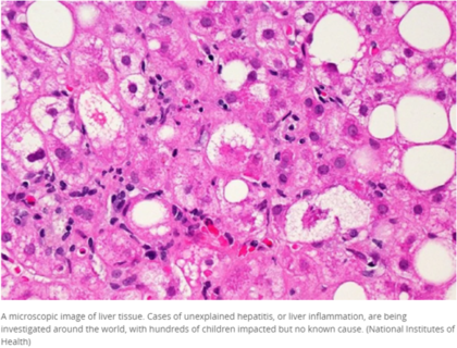 Mounting Health and Economic Implications of the Pandemic