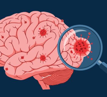 Long COVID is Not Psychosomatic