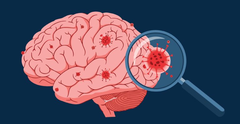 Long COVID is Not Psychosomatic